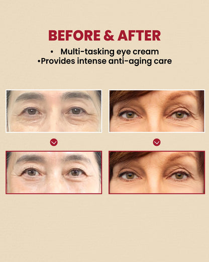 KSECRET SEOUL 1988 Eye Cream : Retinal Liposome 4% + Fermented Bean, Wrinkle Care, Anti-Aging, Skin Elasticity, Pigmentation, Brightening, Retinol, 30Ml/1.01 Fl.Oz.