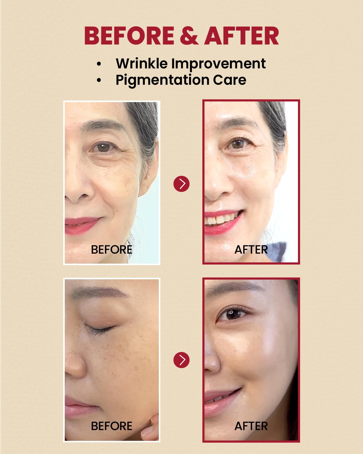 KSECRET | SEOUL 1988 Serum : Retinal Liposome 2% + Black Gingeng, 30Ml/1.01Fl.Oz | 58% Black Gingeng Extract with Retinal, Bakuchiol, Vitamin C & 3 Peptides for Wrinkle Care | Korean Skincare |