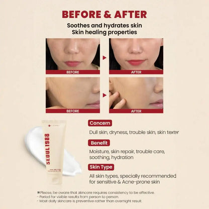 Seoul 1988 Essence : Snail Mucin 93% + Rice 100ml